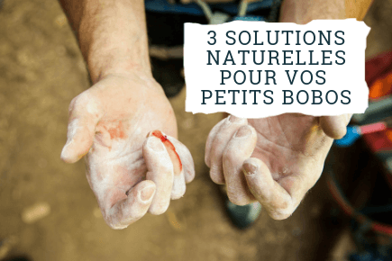 3 solutions naturelles pour vos petits bobos